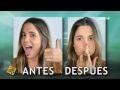 escepticos