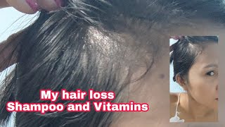 My Hair Loss Shampoo And Vitamins