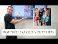 Botched Brazilian Butt Lifts | Dr. Barrett Breaks Down Terrible Plastic Surgery Results