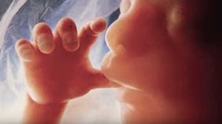 High Risk Pregnancy: Placenta Concerns High Risk Pregnancy: Placenta Concerns