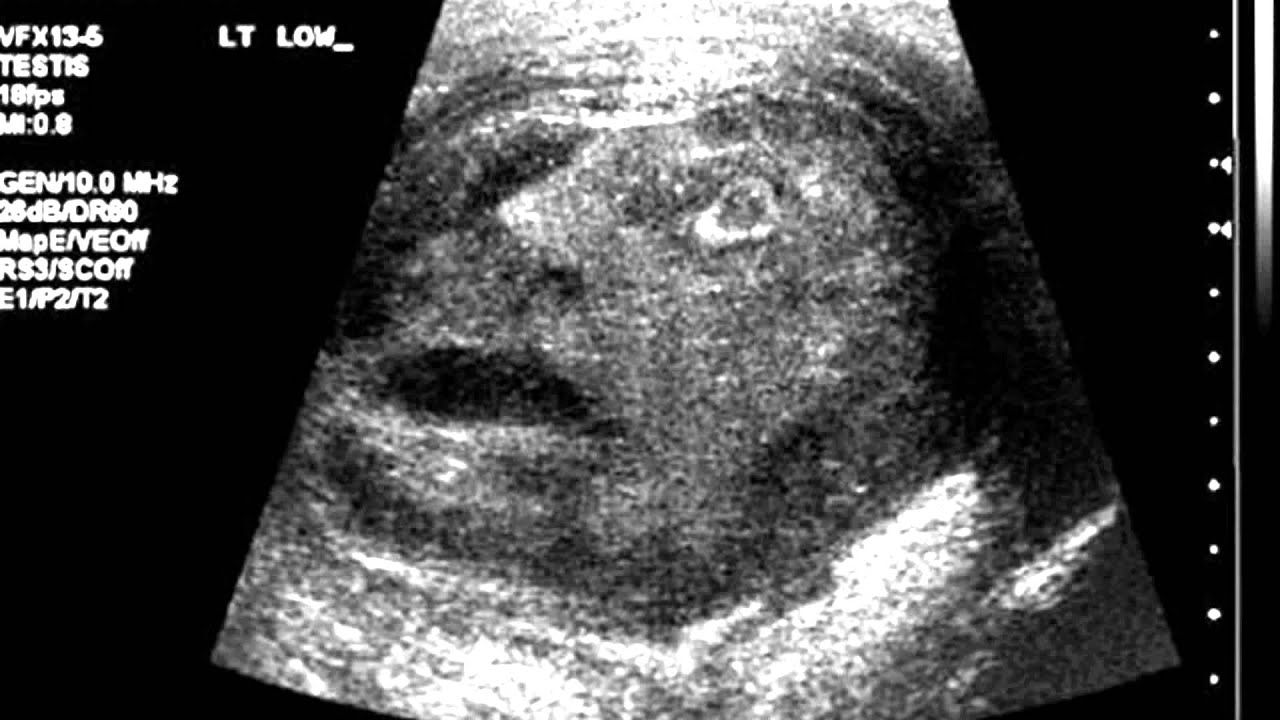 ultrasound scan face strange