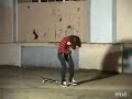 acidburnben