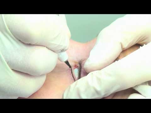 Tags:eyebrow tattooing eyeliner tattooing semi permanent make up permanent