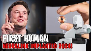 Elon Musk Exposed 2024 Neuralink All-New Update Is Here