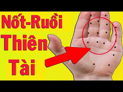 Xem Vận Mệnh Tài Qua Nốt Ruồi Trên Tay Đàn ông