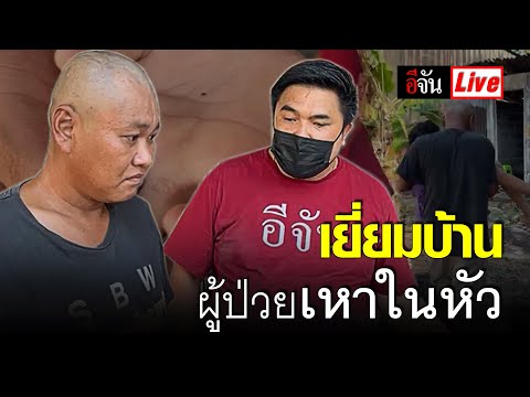Live เหา เจาะหัวฝังไข่ ดูดเลือด กลืนชีวิต | อีจัน EJAN