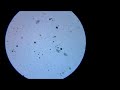 [HD] Life under microscope || Protista