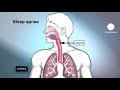 euronews science - Sleep Apnea treatment