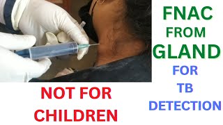 Glands Sample Collection Procedure Fnac Of Cervical Lymph Nodes