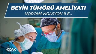 Beyin Tümörü Ameliyatı Nasıl Yapılıyor? Uygulamalı Anlatım