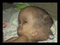 Pai busca tratamento para filha doente em Mato Grosso, conheça a história de Maria Clara