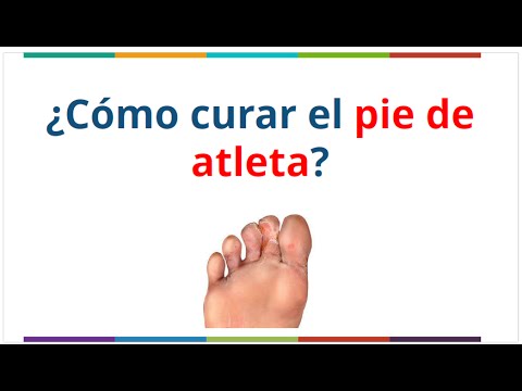 Como es posible contagiarse por el hongo de las uñas en el pie