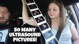 High Risk Ultrasound At 24 Weeks Pregnant Two Vessel Umbilical Cord Update