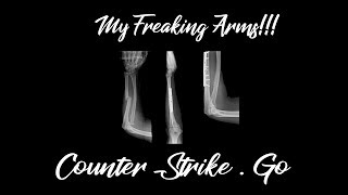 MY ARMS ARE FREAKING BROKEN! - Counter Strike : Global Offencive