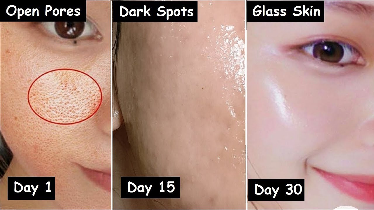 Diminish facial spots permanently