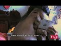China's Elephant Man - My Face Melted: Body Bizarre Episode 7