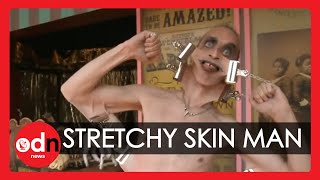 Meet the man with the world's stretchiest skin ... WEIRD!