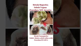 Metoda Non-Invazivapigment Extrasvs Metoda Invaziva Sange