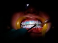 cirugía dental