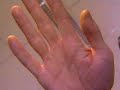 Biometric