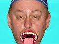 Mouth