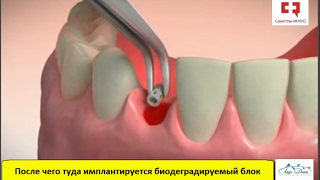 Де Агостини Россия Де Агостини Россия Вязание шапки с отворотом спицами. Подробная схема с