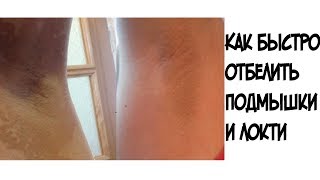 Отбеливание подмышек в домашних условиях отзывы