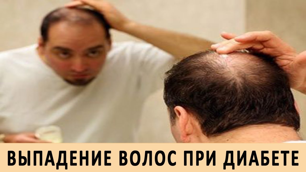 Редеют волосы у мужчины народные средства Редеют волосы у мужчины народные средства