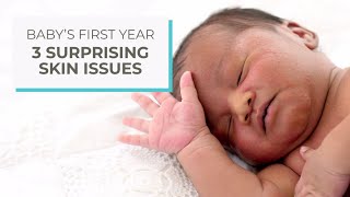 3 Surprising Skin Issues Ad Content By Huggies