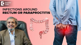 Know why you get Infections around Anus | Paraproctitis - Dr. Rajasekhar M R | D
