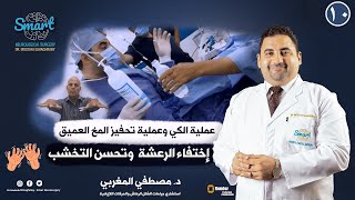 نجاح عملية لرعشة وتخشب الجانب الأيمن و إختفاء الرعشه و تحسن التخشب علاج نقص مادة الدوبامين