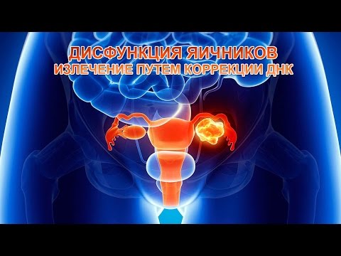 Что такое коррекция яичников 114