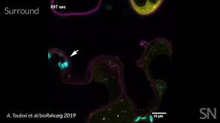 Watch light-harvesting chloroplasts fight off a plant infection | Science News