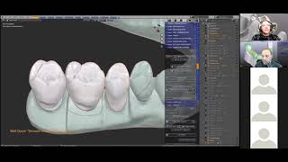 ZOOM- Demonstrating the Crown and Bridge Module