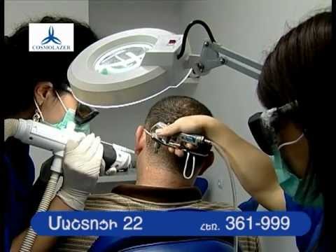 Лазерное эпиляция в ереване Лазерное эпиляция в ереване