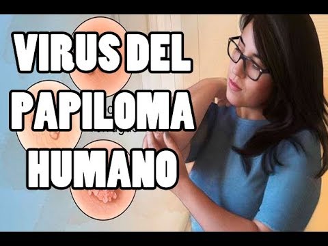 Sanar la tromboflebitis de las venas profundas