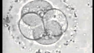 FECUNDACION IN VITRO