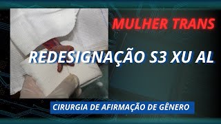 Criação Do Cl Tó Ris Da Mulher Trans