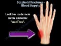 Scaphoid Fractures Blood Supply - Everything You Need To Know - Dr. Nabil Ebraheim