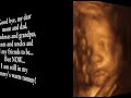 ultrasound 3d 4d