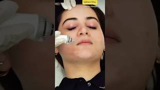 Aiman Khan Skin Treatment