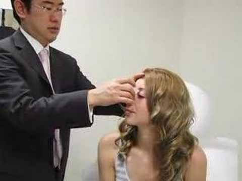 Closed Rhinoplasty Journey - Finesse . Closed Rhinoplasty Journey - Finesse .