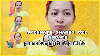 SKINMATE UPDATE + PAANO KUMINIS ANG MUKHA(DIY PIMPLE AND BREAKOUTS REMOVER)