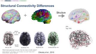 OHBM2022 A framework for brain atlases- an overview and discussion on selecting an atlas for a study