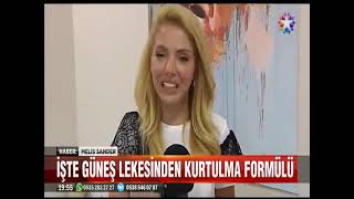 Fi̇gen Hocamizin Güneş Lekeleri̇yle İlgi̇li̇ Star Tv Röportaji