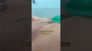 Elimine Seu Capô De Fusca Com A Hidrolipo