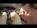Raja Tahi Hidung images Raja Tahi Hidung