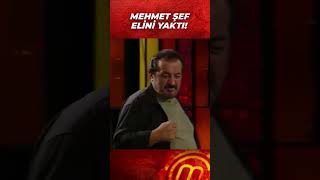 Mehmet Şef Elini Yaktı