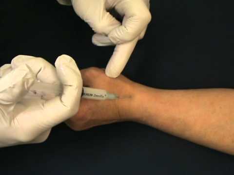 Carpal tunnel steroid injection technique ultrasound