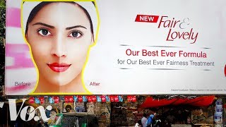 Why the market for skin whitening is growing Why the market for skin whitening is growing